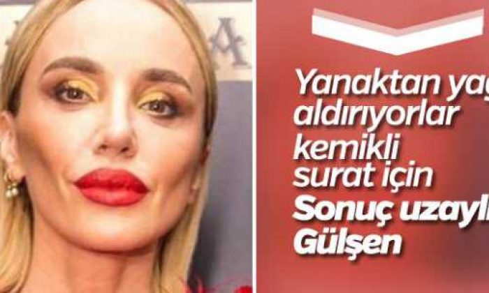 Hollywood yanağı nedir