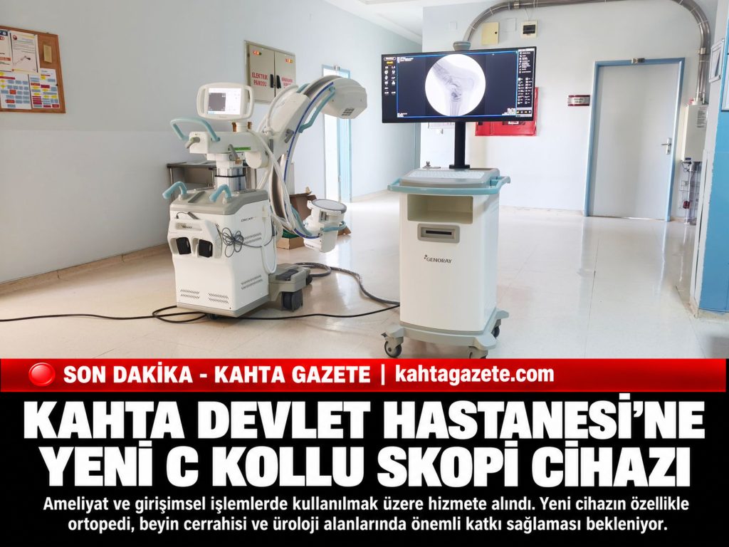 Kahta Devlet Hastanesi’ne Yeni C Kollu Skopi Cihazı