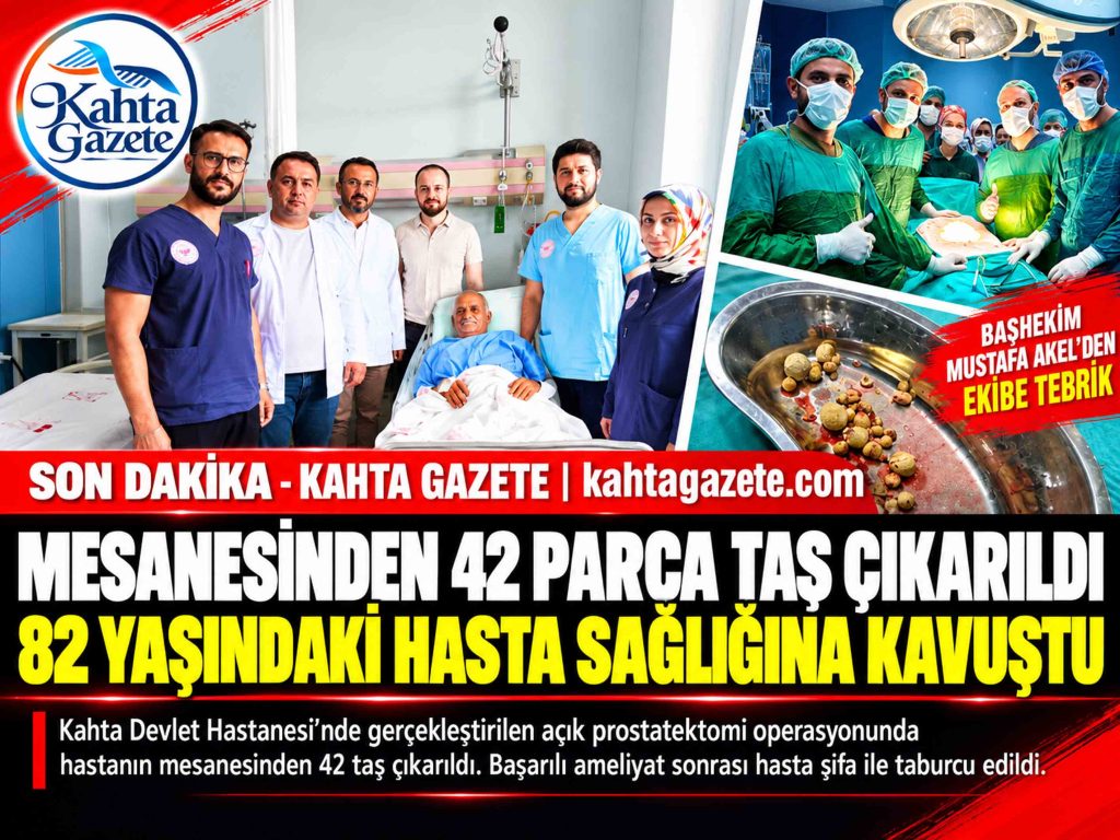 Kahta Devlet Hastanesi’nde gerçekleştirilen başarılı operasyonla, ileri derecede prostat büyümesine bağlı sağlık sorunları yaşayan 82 yaşındaki hastanın mesanesinden 42 adet taş çıkarıldı.